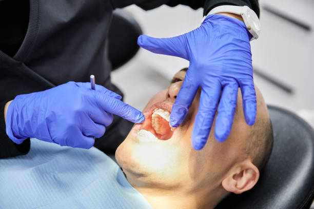 Best Emergency Dental Care for Broken or Chipped Teeth in Edmundson, MO