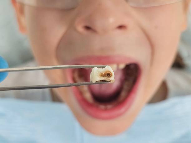 Best Urgent Care for Lost Fillings or Crowns in Edmundson, MO