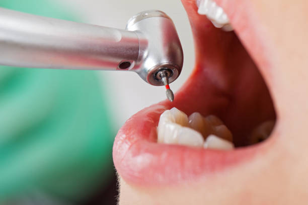 Best Emergency Gum Treatment in Edmundson, MO